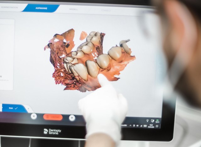 Digitaler 3D-Scan des Kiefers auf dem Behandlungsmonitor